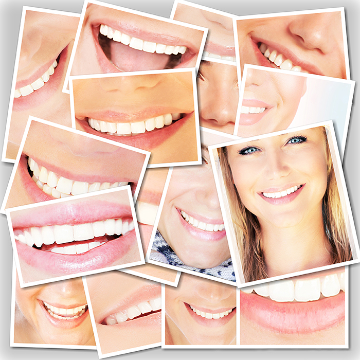 Some of the most common procedures used in cosmetic dentistry include custom dental veneers and professional teeth whitening.